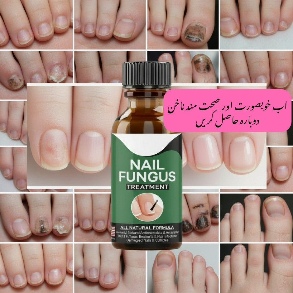 Fast Nail Fungus Treatment Serum
